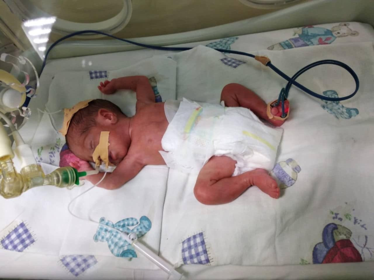 Малкото голямо чудо: Момчил, който се роди 850 грама, вече е първокласник